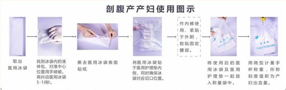 剖腹產 剖腹產