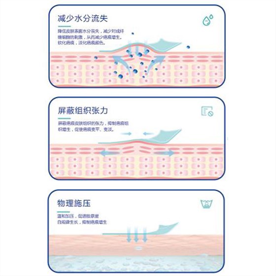 疤痕貼作用原理 疤痕貼作用原理