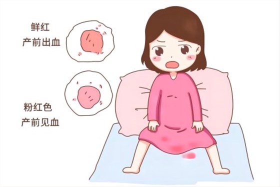 產后出血 產后出血