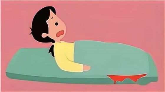 產(chǎn)后出血2 產(chǎn)后出血2