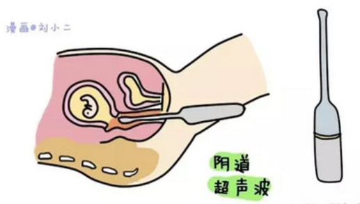 超聲耦合劑 超聲耦合劑