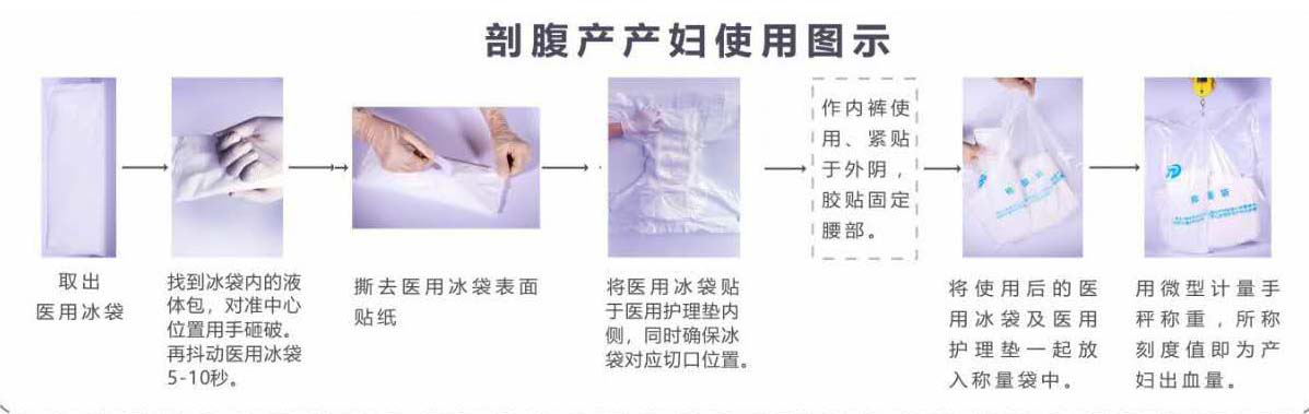 剖腹產 剖腹產