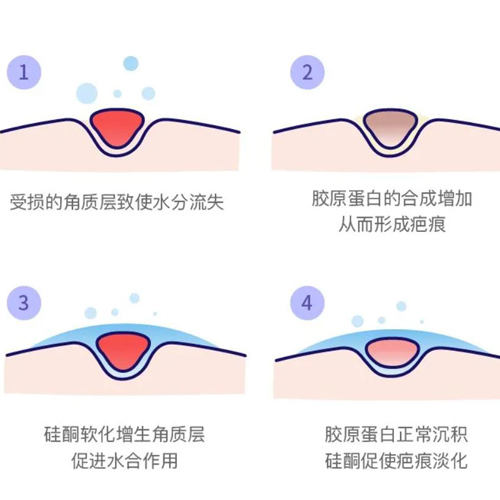 疤痕貼20210625 疤痕貼20210625