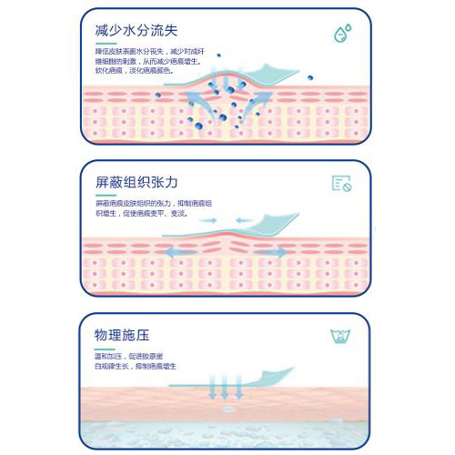 疤痕貼作用原理 疤痕貼作用原理