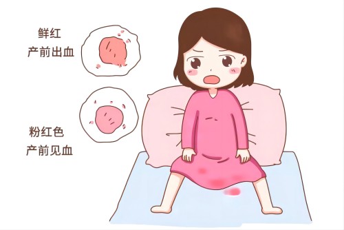 產后出血 產后出血